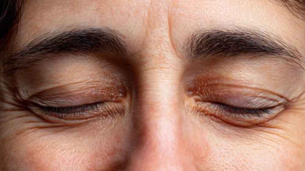 Close up of woman's wrinkles and eyelids before upper eyelid blepharoplasty