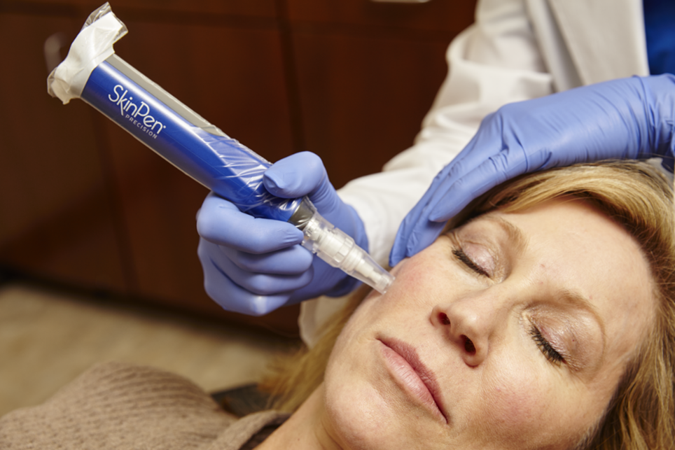 Facial plastic surgeon using SkinPen microneedling pen on patient's face