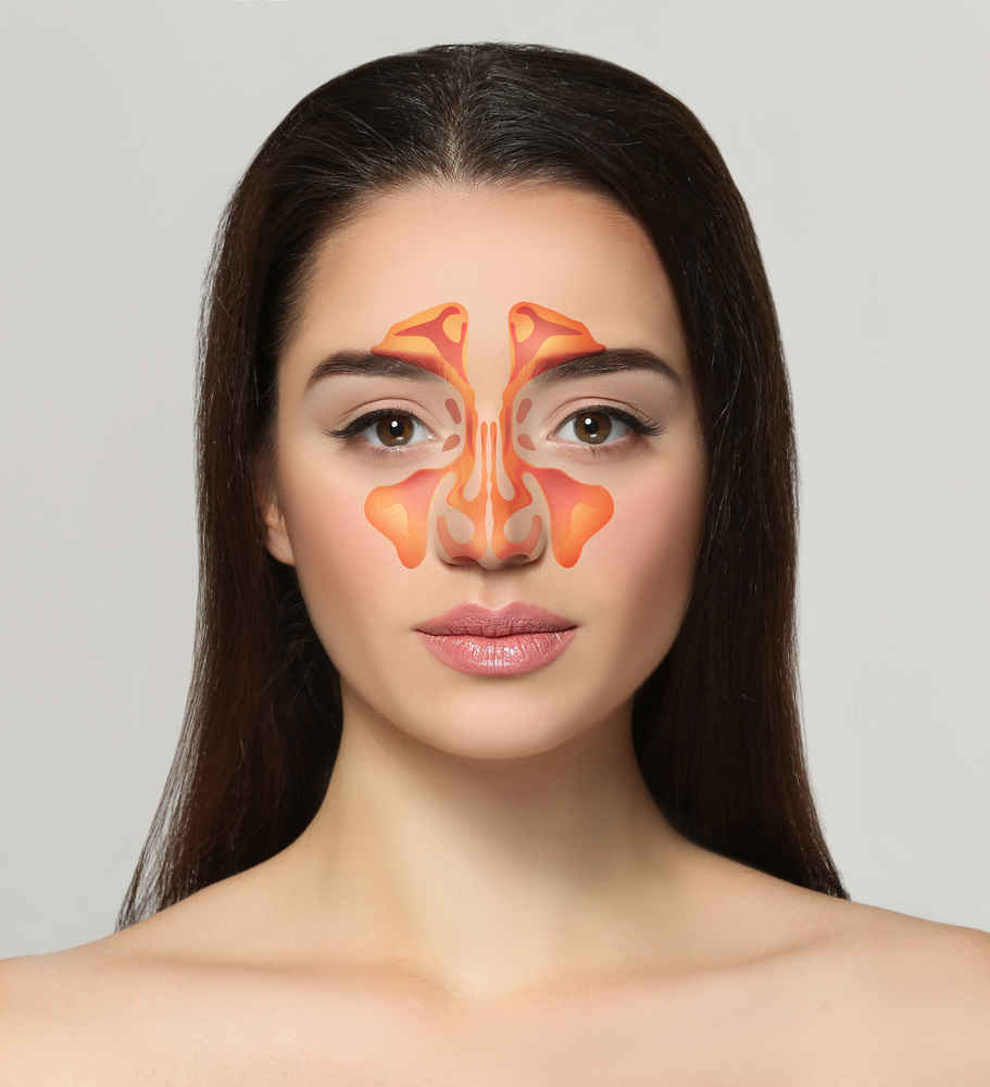 Sinus anatomy of a woman
