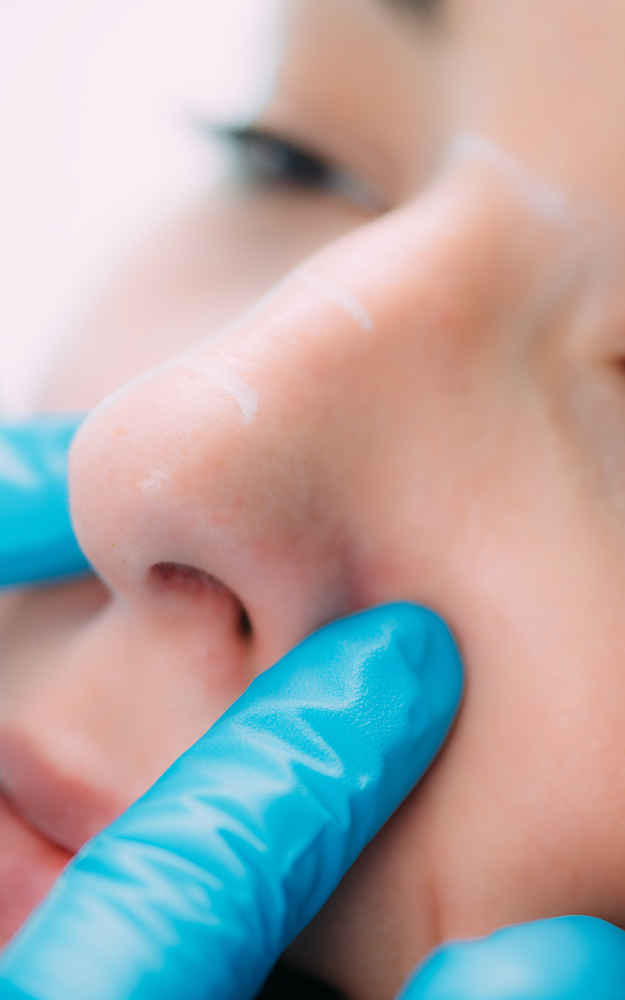 Facial plastic surgeon examining nose before rhinoplasty nose surgery