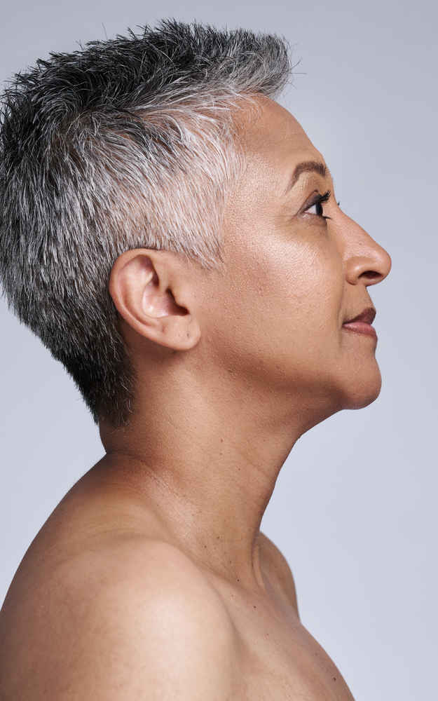 Side view of woman after neck lift surgery