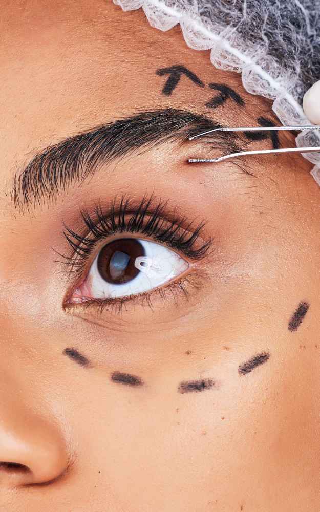 Facial plastic surgeon examining patient's face before browlift surgery