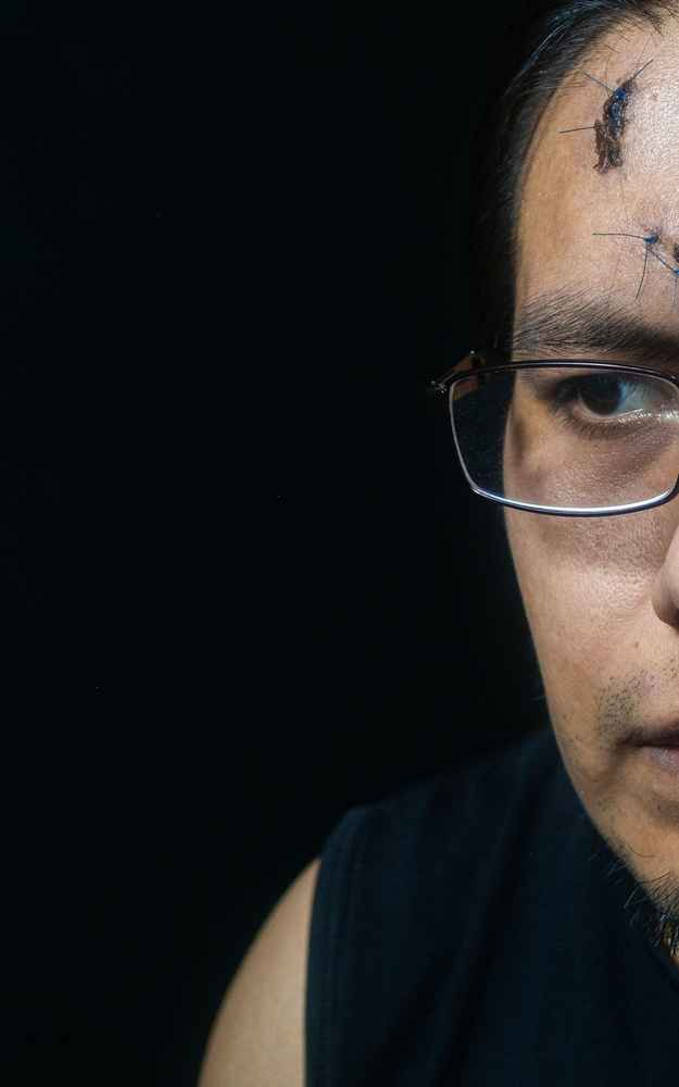 Man before scar revision surgery