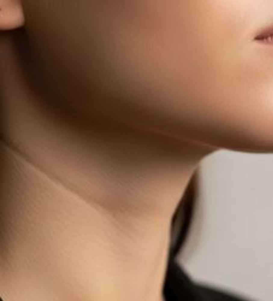 Face/Neck Lift