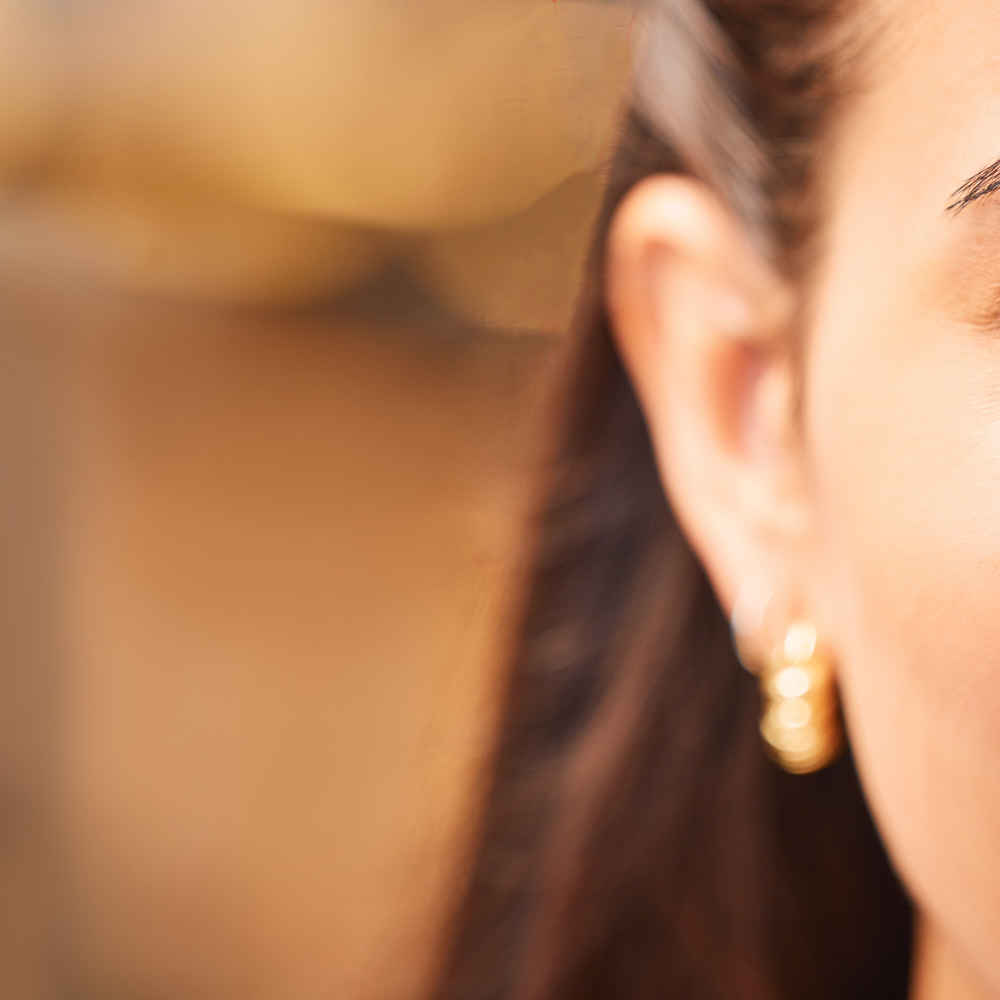 Woman before otoplasty ear pinning surgery