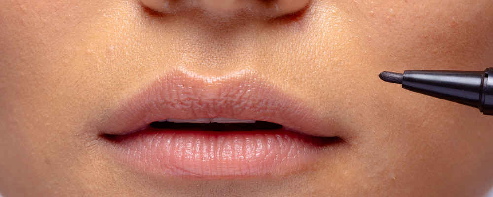 Woman before lip lift surgery