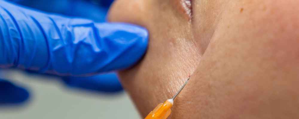 Facial plastic surgeon injecting Sculptra into patient's face