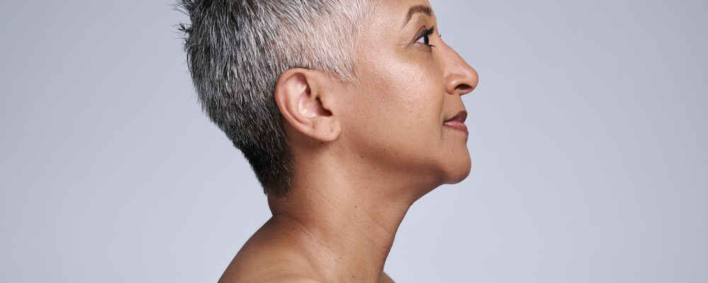 Side view of woman after neck lift surgery