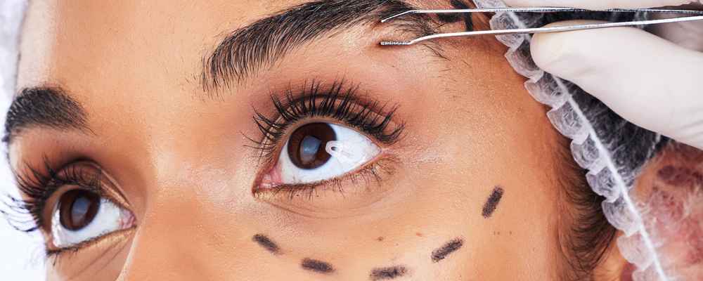 Facial plastic surgeon examining patient's face before browlift surgery