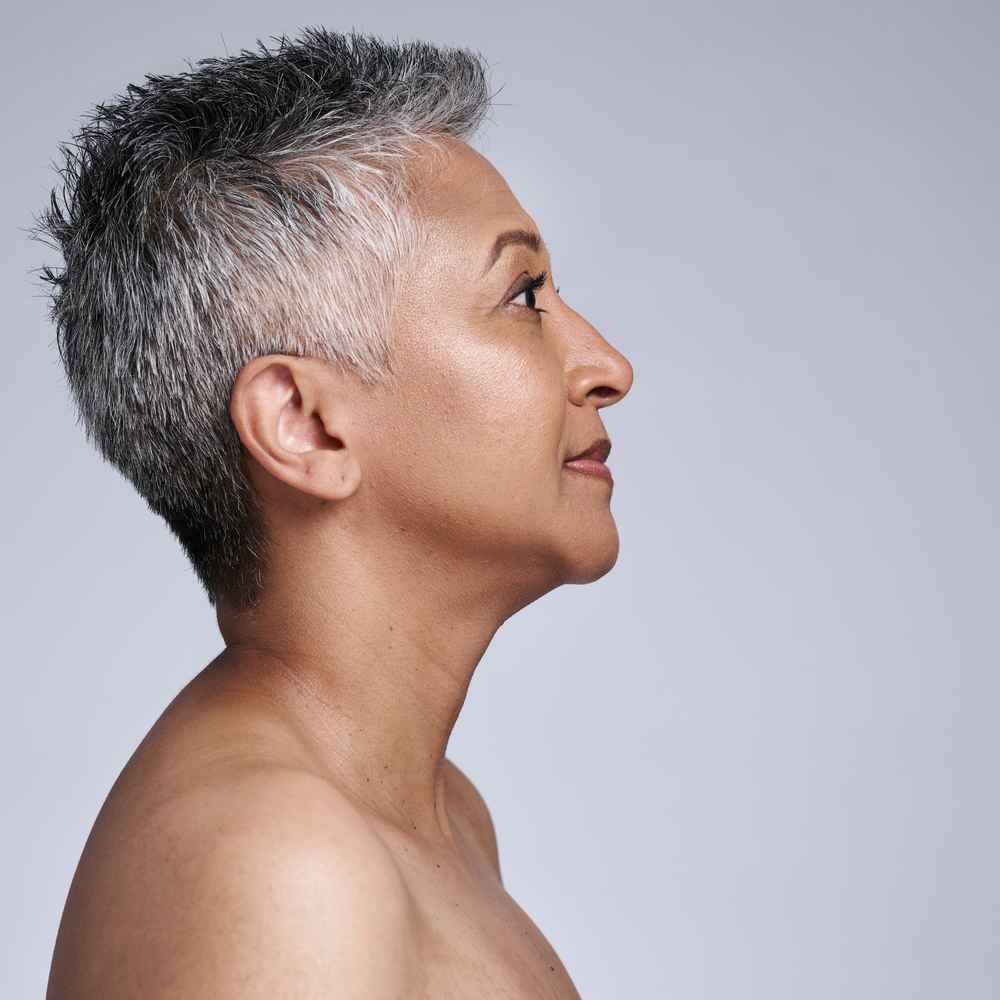 Side view of woman after neck lift surgery