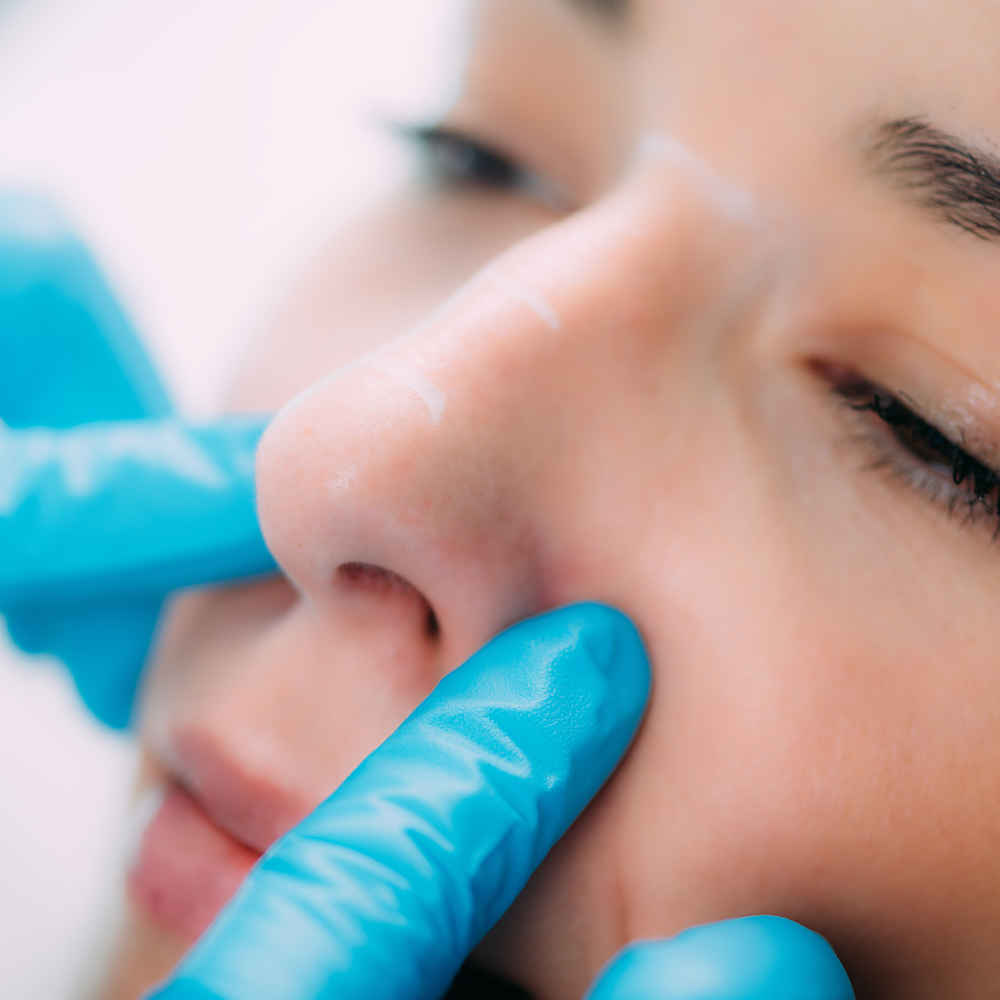 Facial plastic surgeon examining nose before rhinoplasty nose surgery