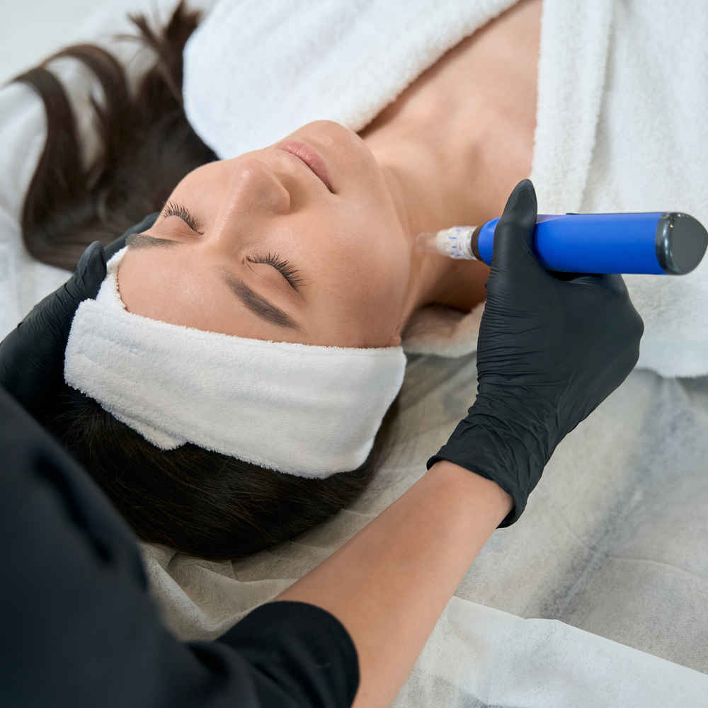 Facial plastic surgeon using SkinPen microneedling pen on patient's neck