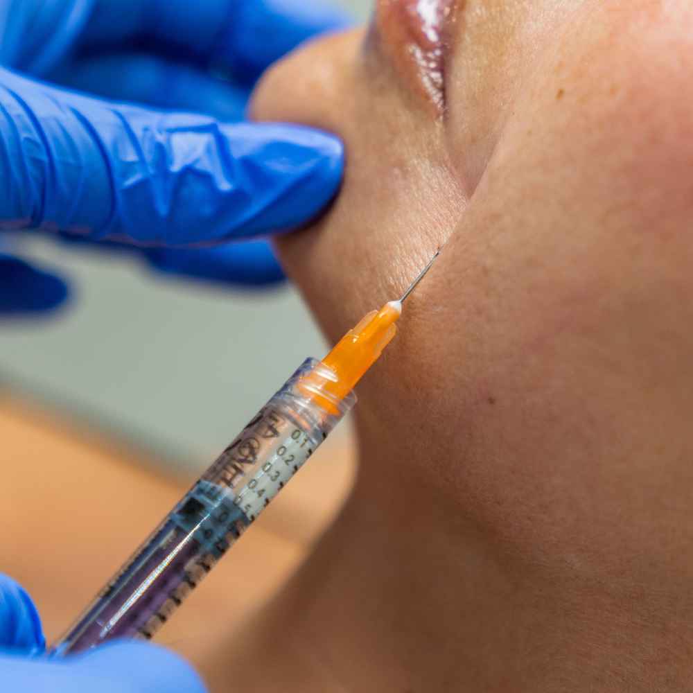 Facial plastic surgeon injecting Sculptra into patient's face